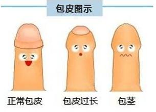 做包皮手术有危险吗?