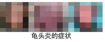 龟头炎会给男性带来哪些危害？