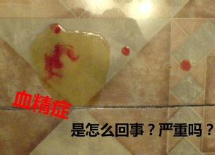 血精症是怎么引起的呢?